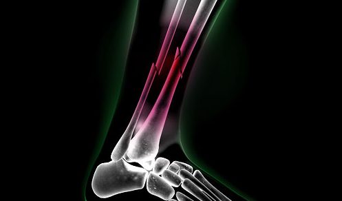 radiografia-magnetoterapia radiografia magnetoterapia e1787138061160